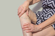 © Solarisys - The varicose veins on a legs of old woman on pastel