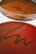 Petri dishes, laboratory cultures