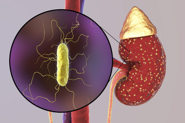 Poster - Pyelonephritis, medical concept, and close-up view of bacteria Proteus, the common causative agent of kidney infection, 3D illustration