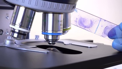 Canvas Print - Study of bacteria under a microscope. Preparation of the microscope. The glass slide with the bacteria for the study. Study of pathogens.