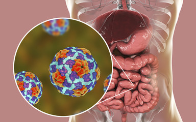 Wall Mural - Hepatitis A viruses in small intestine