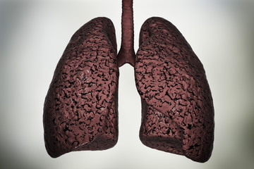 Canvas Print - Smokers lungs, medical concept