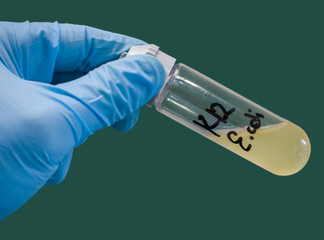 Sticker - Close-up escherichia coli culture. A test tube in the hand. A blue-gloved hand holds a test tube with Escherichia coli culture.