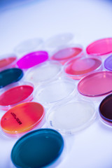 Wall Mural - differents cultivation in petri dishes in laboratory