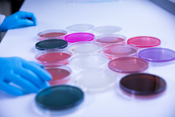 Wall Mural - differents cultivation in petri dishes in laboratory