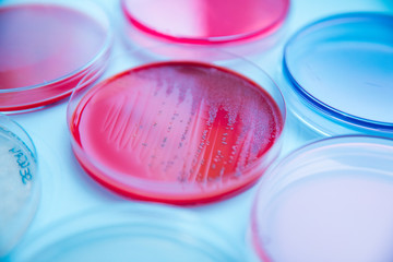 Wall Mural - differents cultivation in petri dishes in laboratory