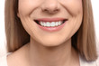 © New Africa - Young woman with beautiful smile, closeup. Teeth whitening