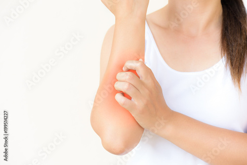 Fotomural Close up woman arm scratch the itch by hand at home