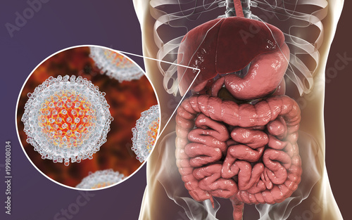 Hepatitis C Virus Infection Medical Concept 3d Illustration Kaufen Sie Dieses Foto Und Finden Sie Ahnliche Bilder Auf Adobe Stock Adobe Stock Hepatitis C Virus Infection Medical Concept 3d Illustration Kaufen Sie Dieses Foto Und Finden Sie Ahnliche Bilder Auf Adobe Stock Adobe Stock