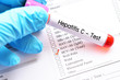Blood sample for hepatitis C virus (HCV) test
