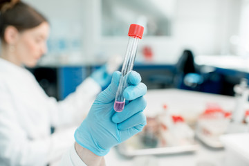 Wall Mural - Holding test tube with pink liquid in the laboratory