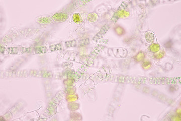 Wall Mural - Filamentous algae are single algae cells that form long visible chains