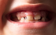 The Teeth Of The Boy As A Background