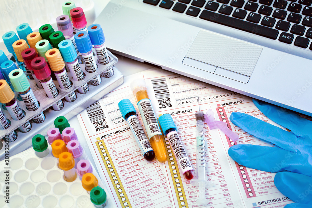 laboratory work table with tools of a lab technician to perform a blood ...