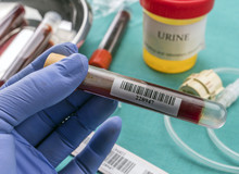 Doctor Holds Blood Sample At A Hospital Table, Conceptual Image