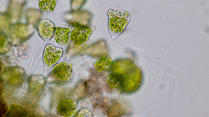 Wall Mural - Vorticella (organism) in waste water under the microscope.