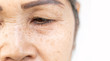 wrinkled of old asian woman skin eyelid