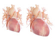 3d rendered, medically accurate illustration of an enlarged heart