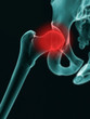 © Doug Armand - X-Ray effect image of hip section of Human with red highlighting the joint area