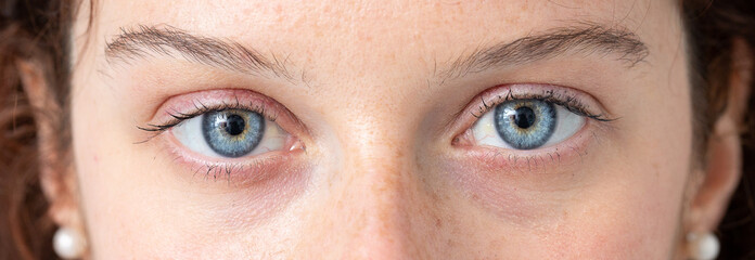 blue eye of young caucasian woman