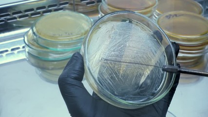 Poster - A close-up of the selection of bacteria from one cup and seeding with a bacteriological loop on another cup. The work of a microbiologist in the laboratory.