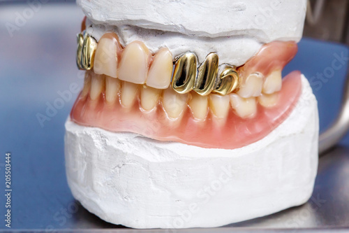 model of teeth with clay