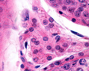 Poster - Leydig cells. Human testicle