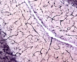 Wall Mural - Microglia. Cerebellar cortex