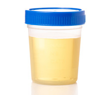 Plastic Container With Urine Analysis On White Background Isolation