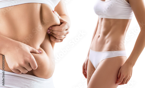 Fotomural Collage of woman body before and after weight loss.