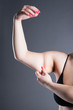 © staras - Fat and cellulite removal concept, overweight female hand