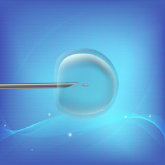 In vitro fertilization IVF. Artificial insemination. ICSI. The ovum egg, needle and spermatozoon. Illustration for web or typography magazine, brochure, flyer, poster. Blue science background.