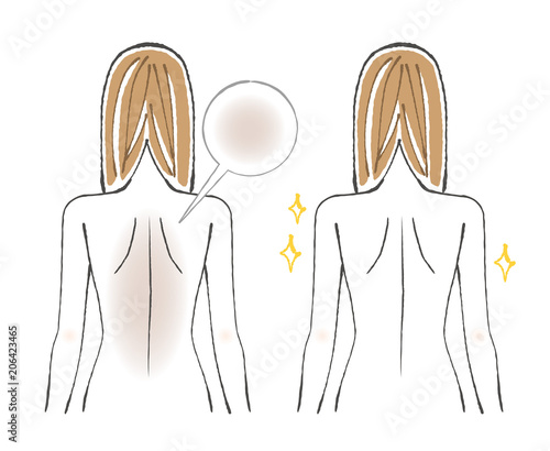 背中のビフォーアフター くすみ 黒ずみ Stock Vector Adobe Stock 背中のビフォーアフター くすみ 黒ずみ Stock Vector Adobe Stock