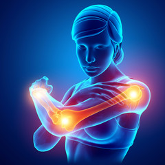 Poster - Women Feeling Arm joint pain