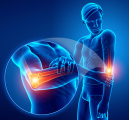 Wall Mural - 3d Illustration of Male Feeling Elbow pain