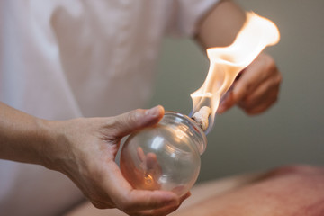 Woman preparing glass cup with flame for cupping therapy for pain relief