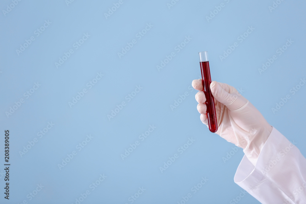 Lab worker holding test tube with blood sample on color background