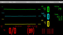 ICU Screen Monitoring Dying Patient, Vital Signs Dropping, Clinical Death. 3D Illustration