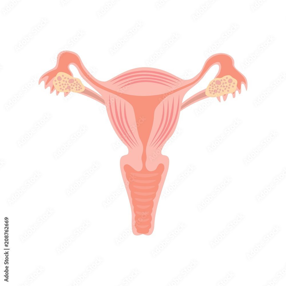 Uterus and ovaries, organs of female reproductive system Stock Vector ...