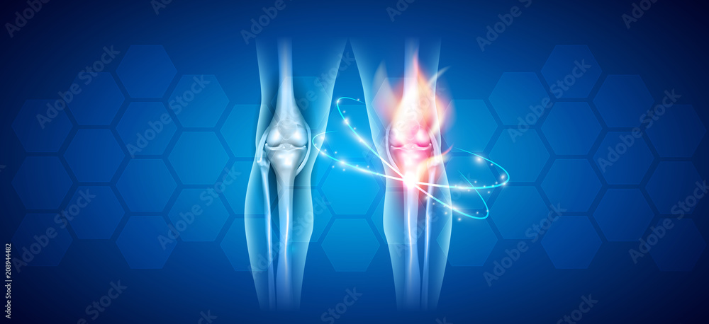 Joint problems and treatment abstract scientific background  - obrazy, fototapety, plakaty 