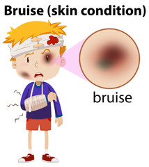 Sticker - A Boy Having Bruise on Face