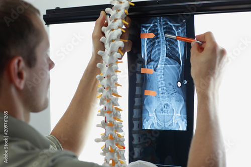 Fotografía Professional with model of spine watching image of chest at x-ray film viewer