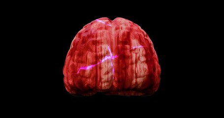 Sticker - human brain with blood vessels and blood and lightnings as electrical nervous impulses   brain organ concept active synapses  3D rendering