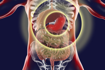 Poster - Human digestive system with highlighted stomach, 3D illustration. Concept for treatment and prevention gastric diseases