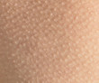 © nataba - human skin is covered with small goosebumps and pimples from the cold and fright close-up