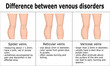 Illustration of difference between venous disorders, such as spider veins, reticular veins and varicose veins.