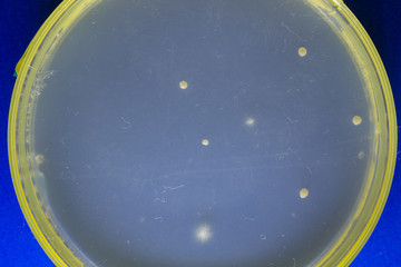 Poster - Petri dish with pathogenic organisms