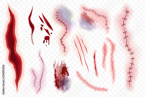 Foto Realistic vector surgical stitches, scars, bruise and slaughter set isolated on the alpha transperant background