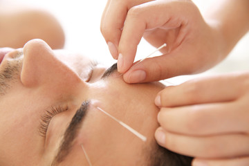 Young man undergoing acupuncture treatment in salon, closeup