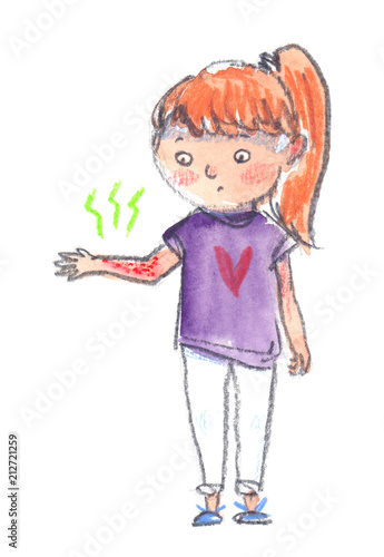 Cute Cartoon Child Looking At Strange Rash On Her Arm Illustration Painted In Watercolor And Colored Pencils On Clean White Background Buy This Stock Illustration And Explore Similar Illustrations At Adobe
